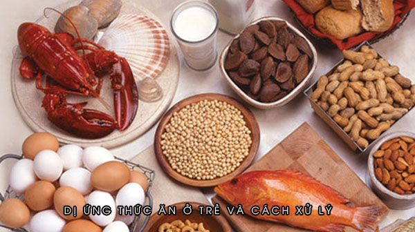 Dị ứng thức ăn ở trẻ và cách xử lý